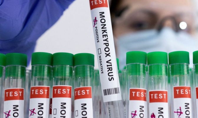 魁北克省确诊15例猴痘 联邦疫苗支援